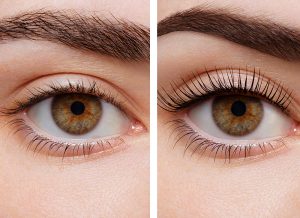 Lash lift botoks